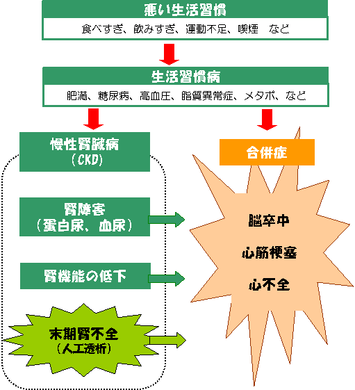 CKDの原因は生活習慣病。CKDから人工透析や脳卒中や心筋梗塞につながります。